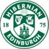 Hibernian FC U20